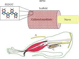 peripheral nerve interface